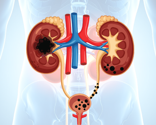 uro Diagnostic_